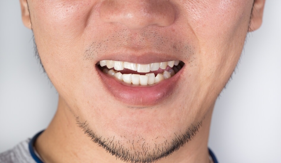 Orthodontics | Dawson Dental Centre | General & Family Dentist | Burnaby | BC