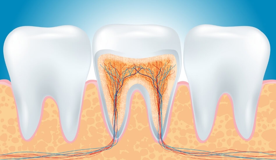 Root Canal Therapy | Dawson Dental Centre | General & Family Dentist | Burnaby | BC