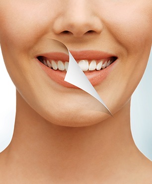 Cosmetic Dentistry | Dawson Dental Centre | General & Family Dentist | Burnaby | BC