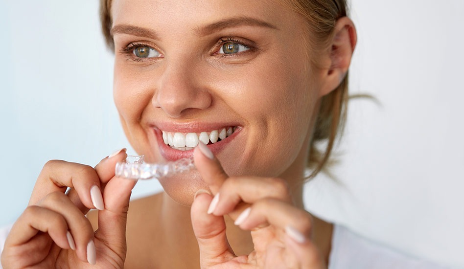 Invisalign Clear Aligners in Burnaby, BC | Dawson Dental Centre