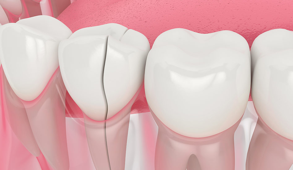 Restorative Dentistry | Dawson Dental Centre | General & Family Dentist | Burnaby | BC
