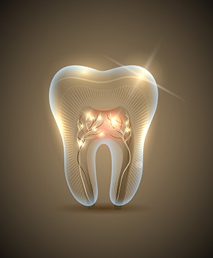 Root Canal Therapy | Dawson Dental Centre | General & Family Dentist | Burnaby | BC