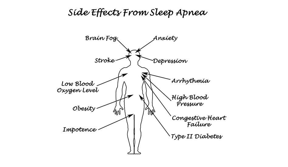 Sleep Apnea Symptoms | Dawson Dental Centre | Sleep Apnea Solutions Burnaby