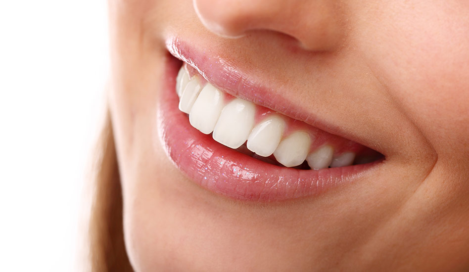 Teeth Whitening | Dawson Dental Centre | General & Family Dentist | Burnaby | BC